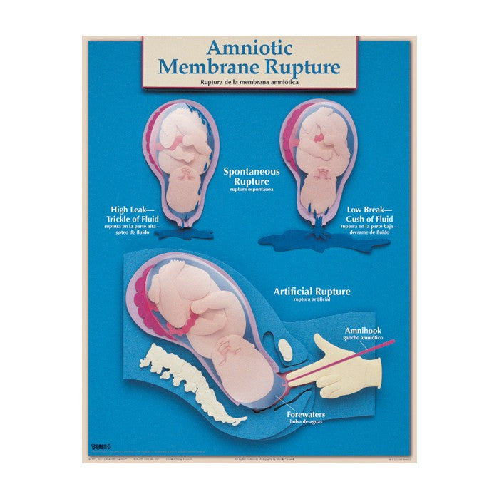 Essential Labour and Birth Laminated Chart Set (Set of 6, English/Spanish)