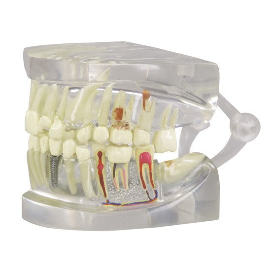 Transparent Jaw with Teeth Model