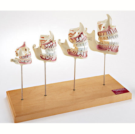 Teeth & Jaw Development Model Set (4 part)