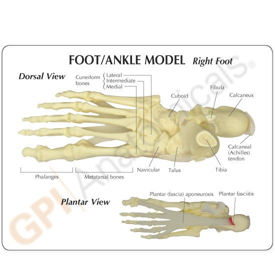Foot and Ankle Model with Plantar Fasciitis