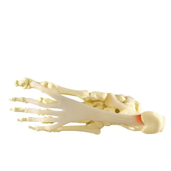 Foot and Ankle Model with Plantar Fasciitis