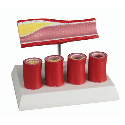 Artery Cross Section Model (4 part)