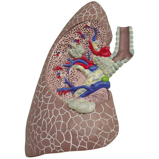Life-size two-sided lung anatomy models, featuring 4 cutaway sections
