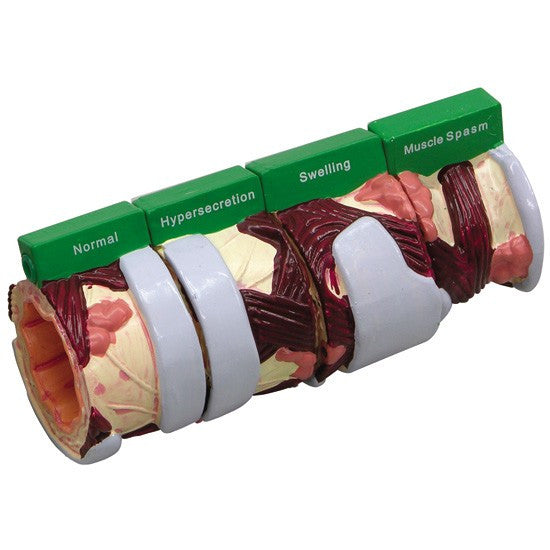 Bronchus Model (4 stages)