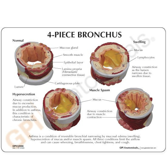 Bronchus Model (4 stages)