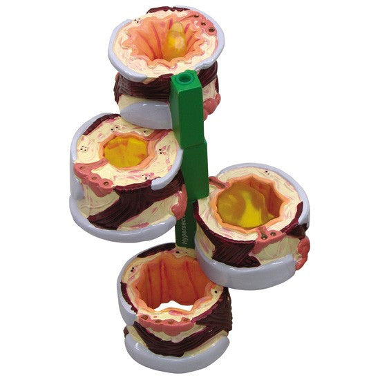Bronchus Model (4 stages)