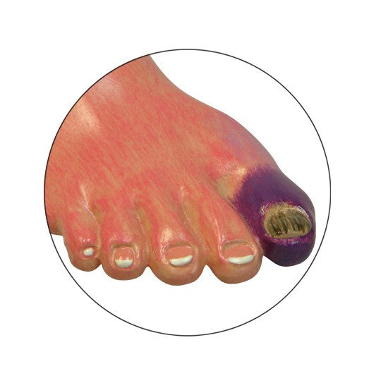 Type II Diabetes Model (8 part)