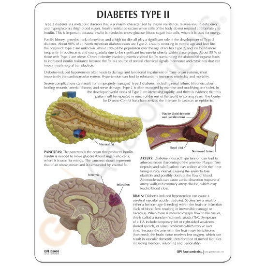 Type II Diabetes Model (8 part)