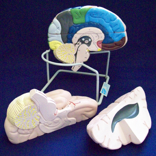 Enlarged Coloured Brain Model (4 part)