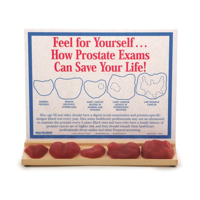 Prostate Exam Display