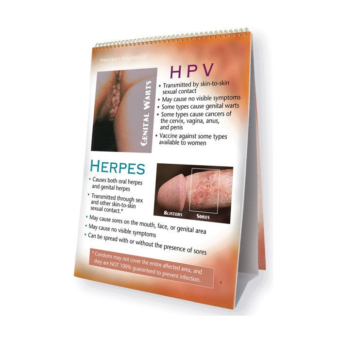 Sexually Transmitted Diseases Flip Chart
