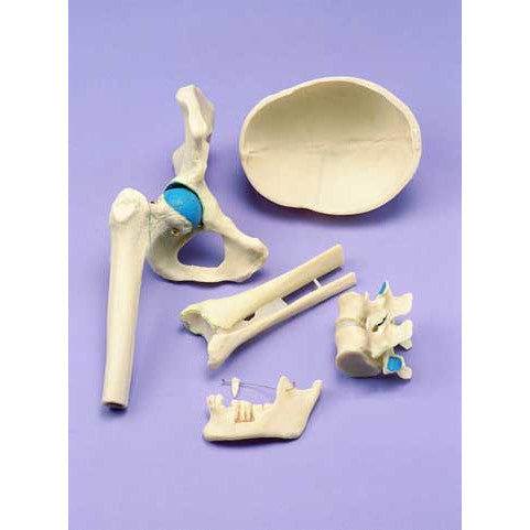 Joint Types Demonstration Model (Set of 5)