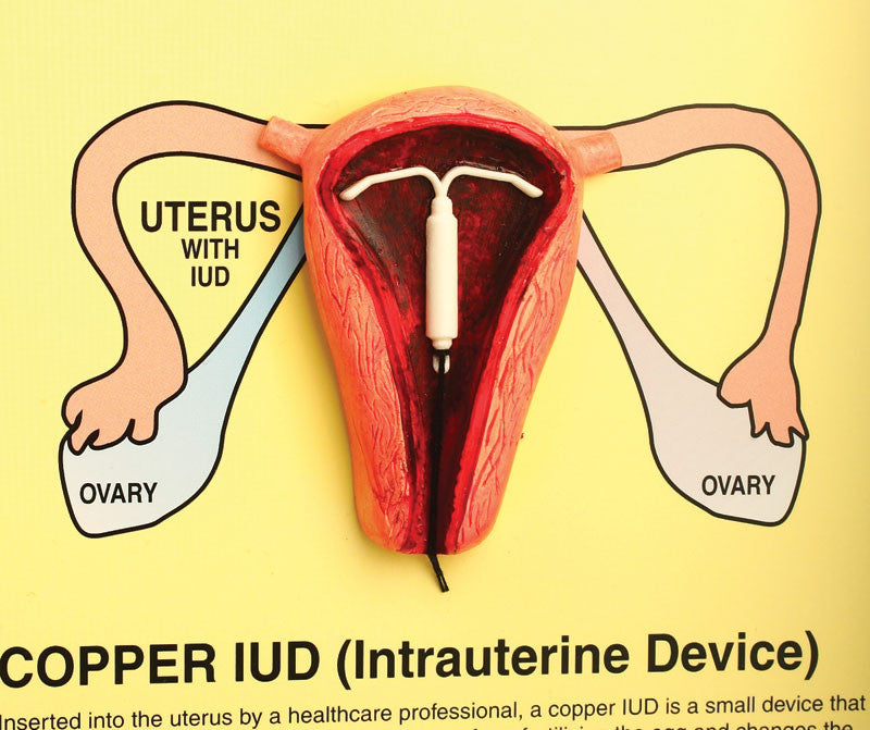 A Guide to Contraceptives Display Kit