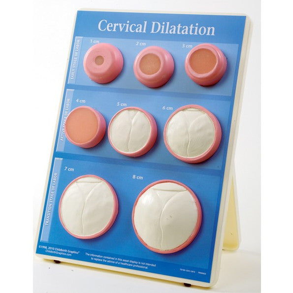 Cervical Dilation Easel Display