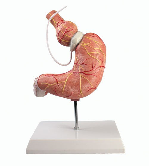 Stomach Model with Gastric Band