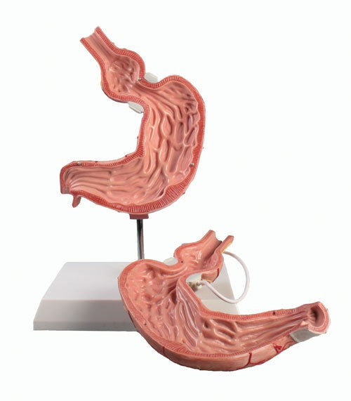 Stomach Model with Gastric Band