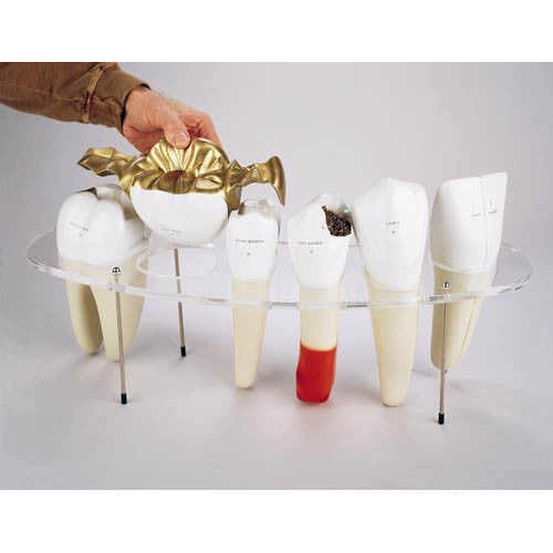 Dental Morphology Series (10 times life size, 7 Part)