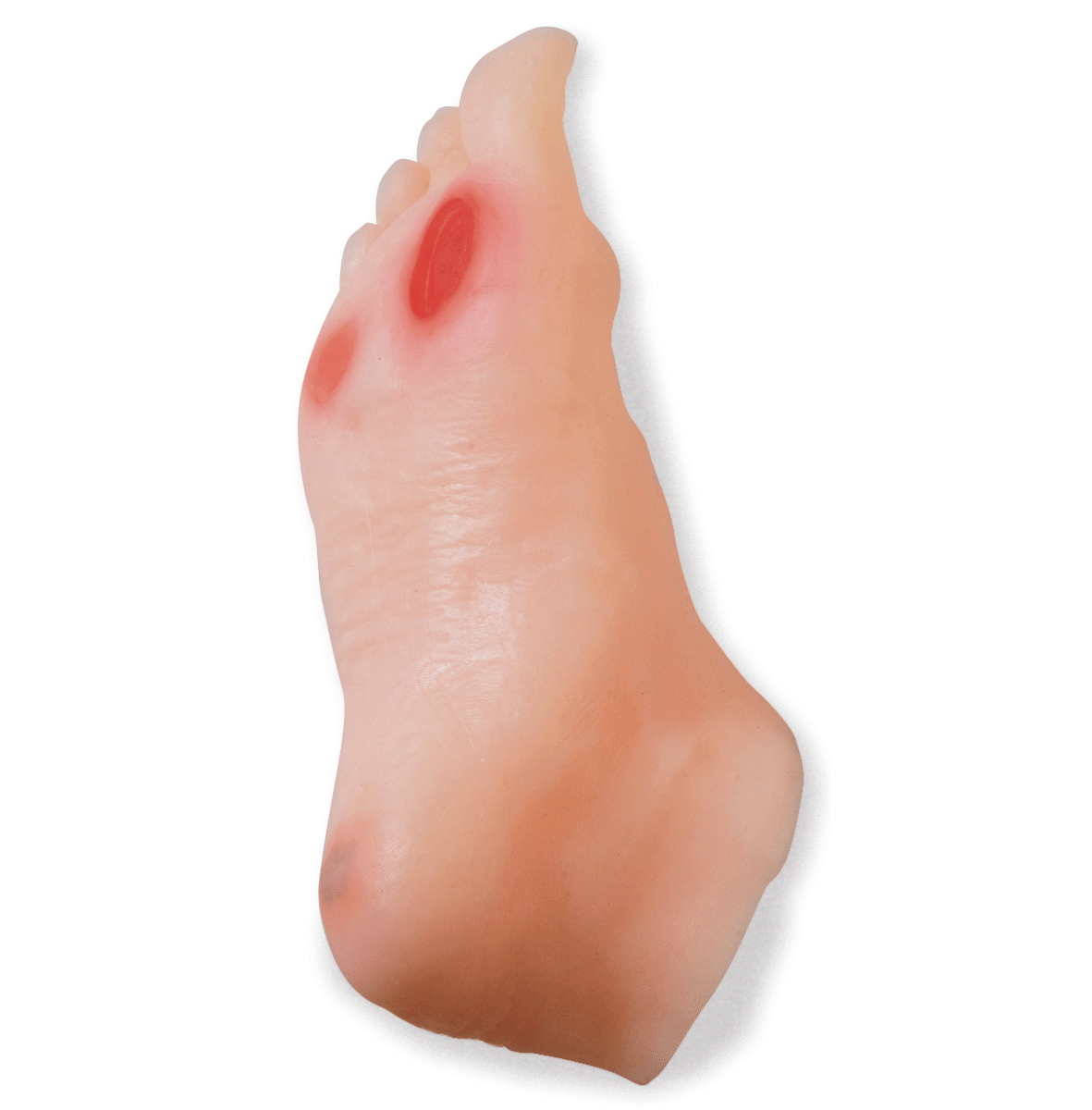 Diabetic Foot Model