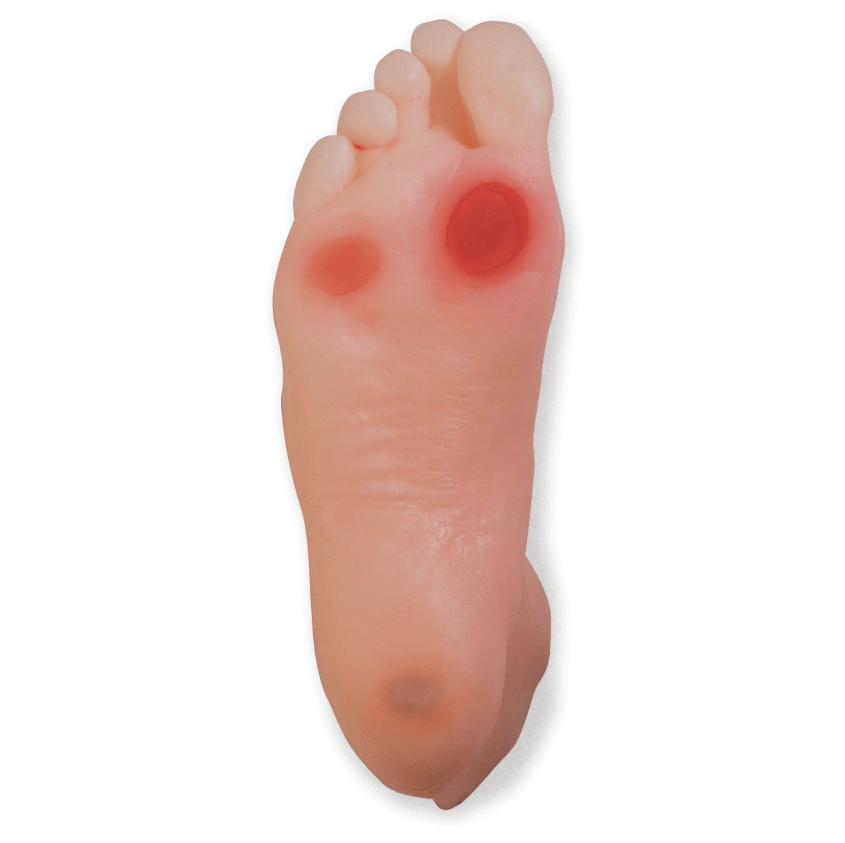 Diabetic Foot Model