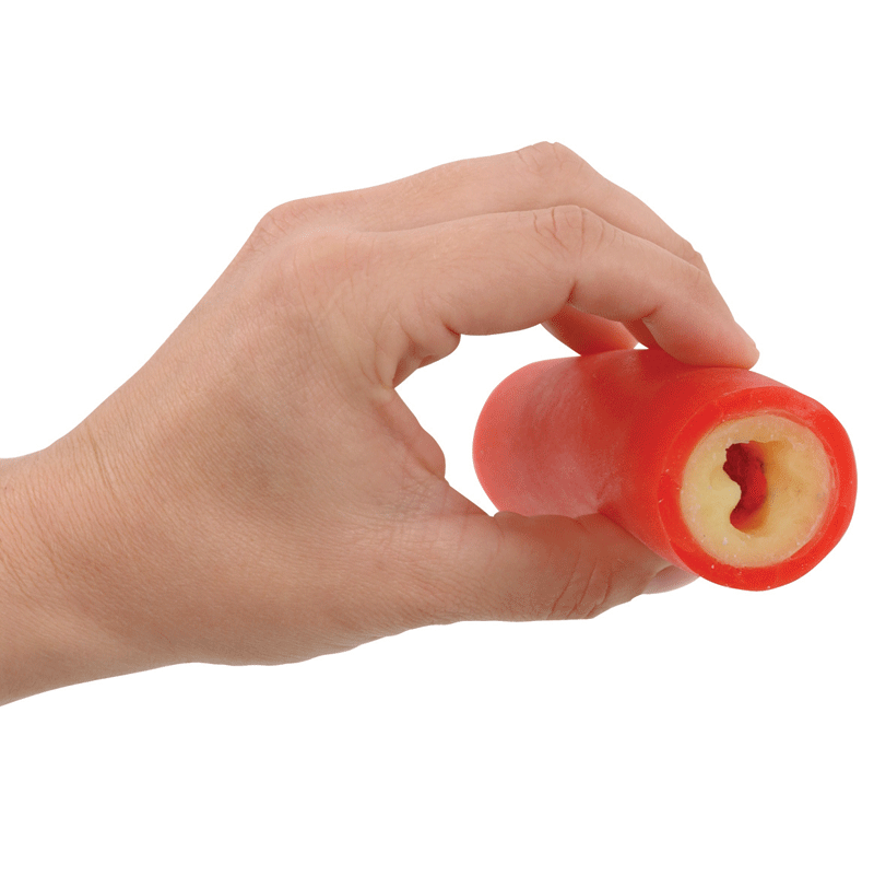 Giant Clogged Artery Model