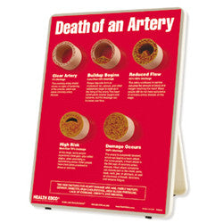 Death of an Artery Easel Display