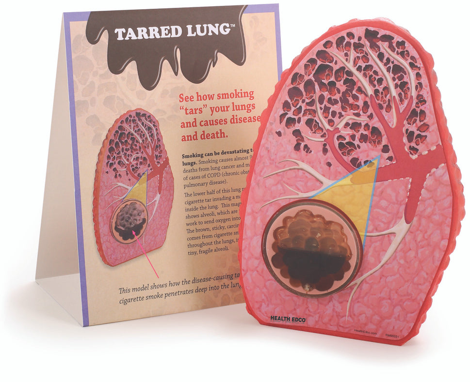 Tarred Lung Model