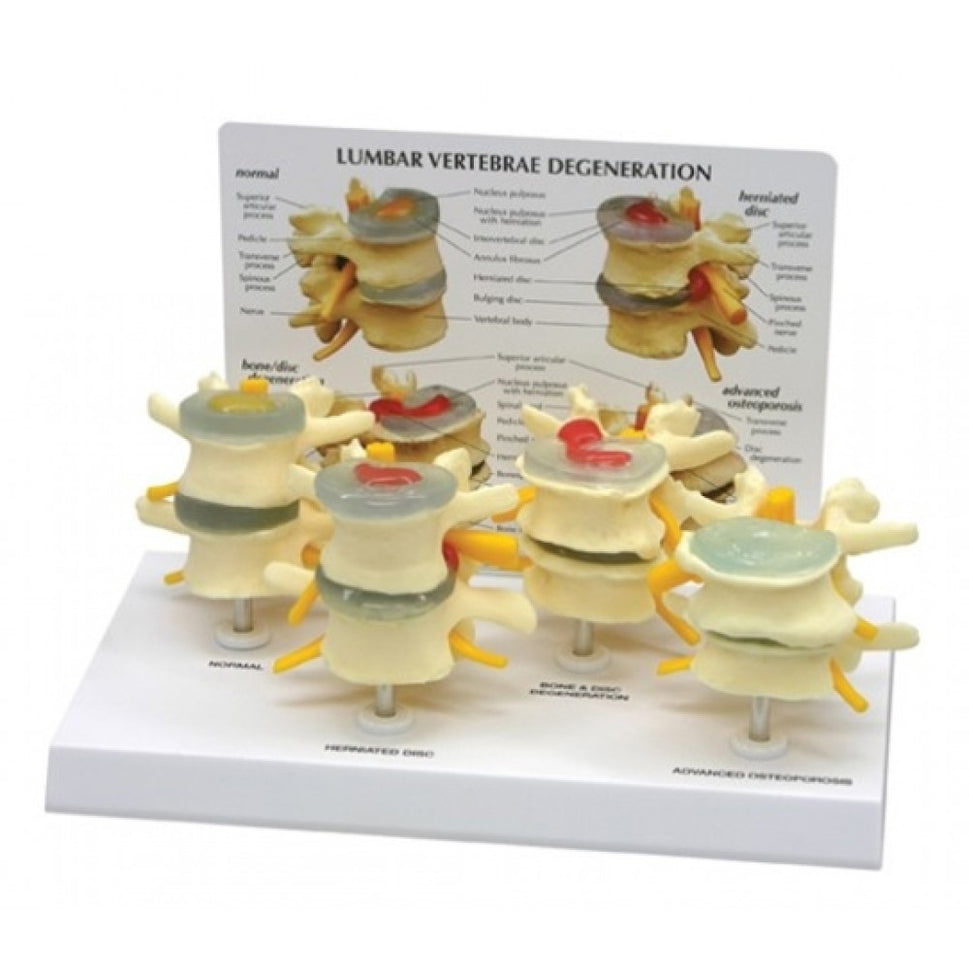 Joint Pathology Model Collection (5 part)