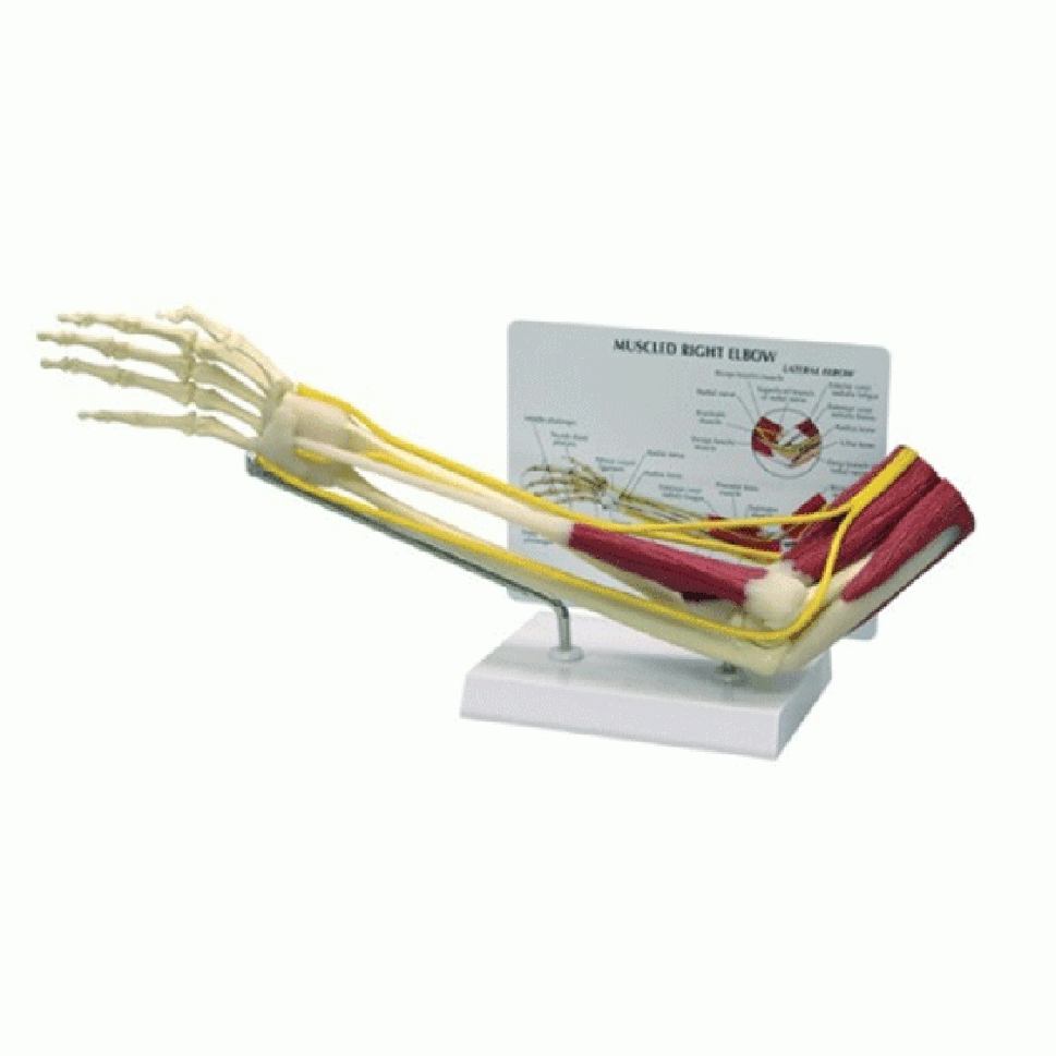 Upper Limb Patient Education Collection