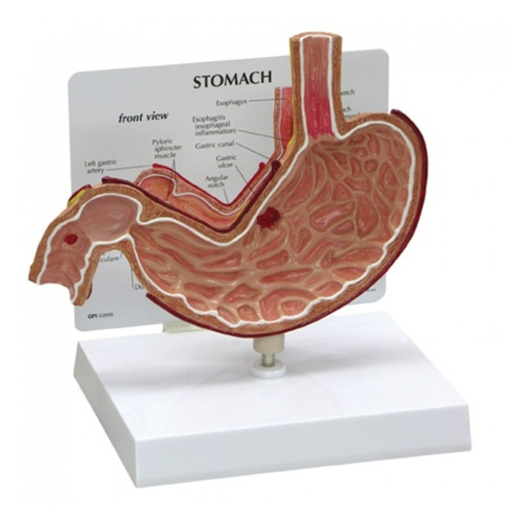 Stomach Model