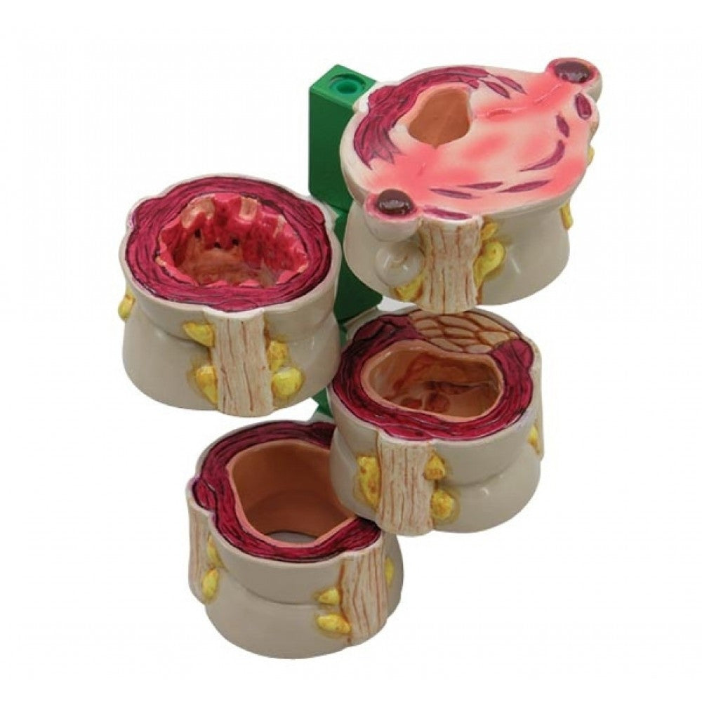 Digestive System Anatomy & Pathology Collection