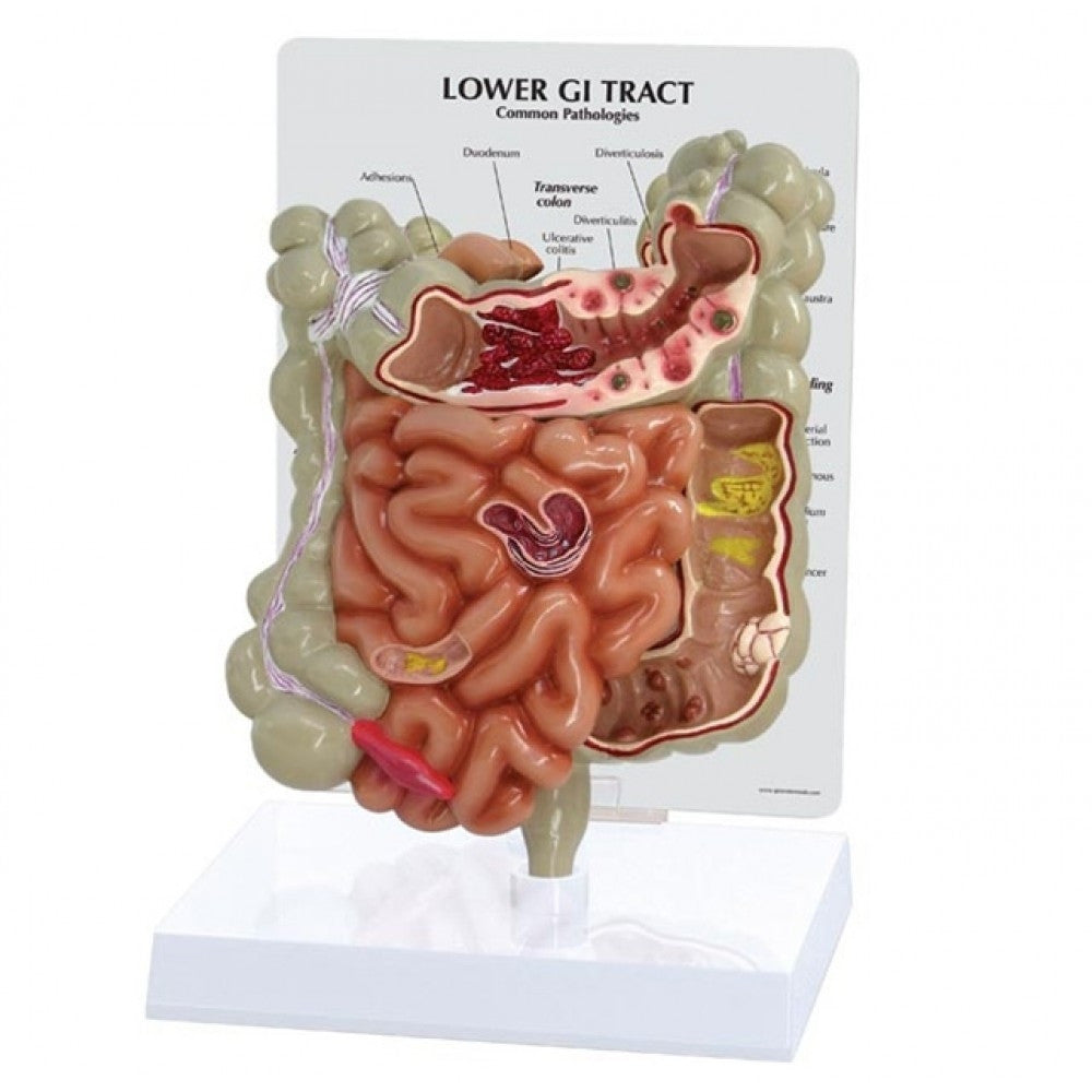 Lower Gastrointestinal Tract Model