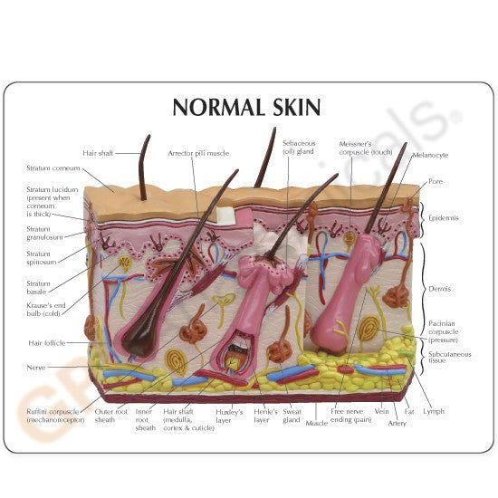 Normal / Acne Skin Model
