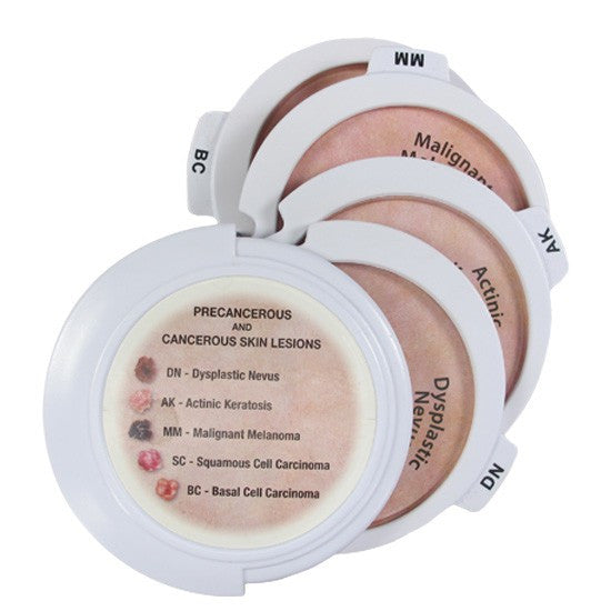 Precancerous and Cancerous Skin Lesions Disk Set