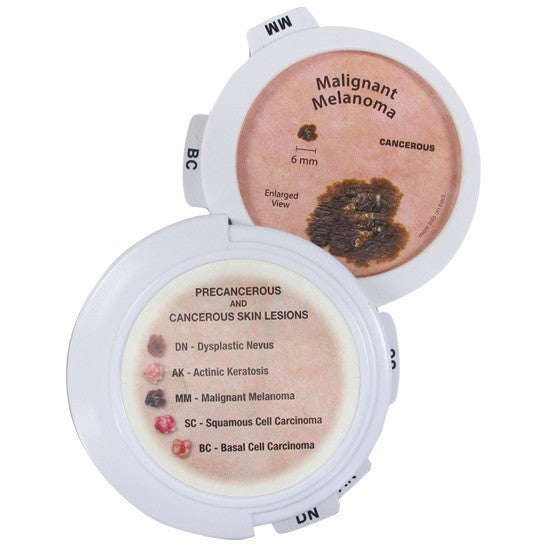 Precancerous and Cancerous Skin Lesions Disk Set