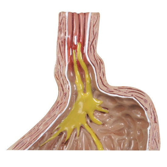 Models each feature  a cross-section of the stomach and oesophagus