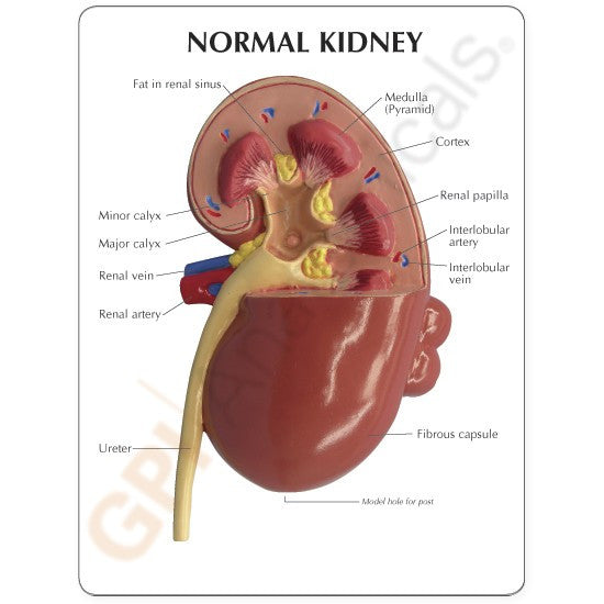 Normal / Diseased Kidney Model