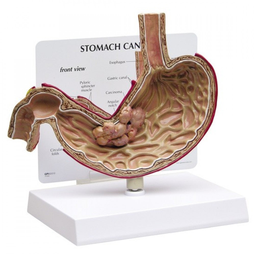 Digestive System Anatomy & Pathology Collection