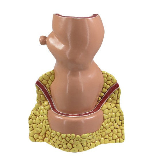 Haemorrhoid patient education model