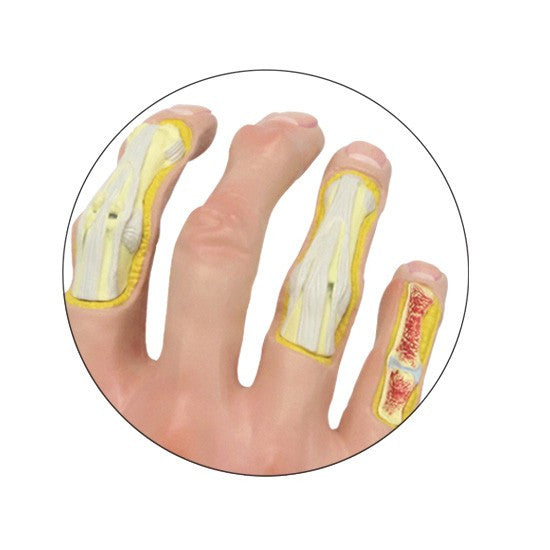 Osteoarthritis (OA) Hand Model