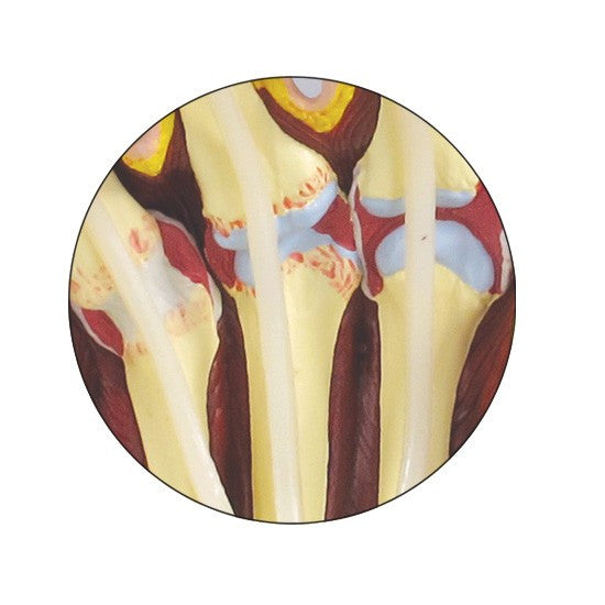 Rheumatoid Arthritis (RA) Hand Model