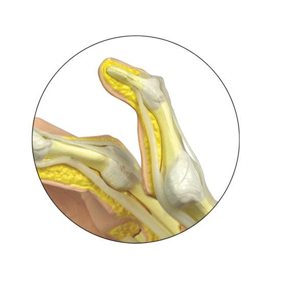 Rheumatoid Arthritis (RA) Hand Model