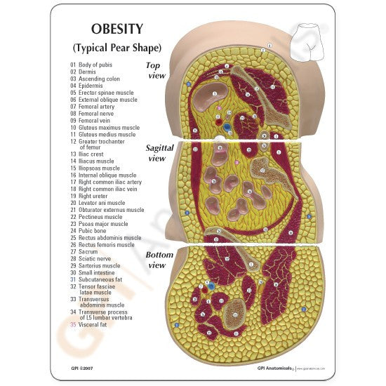 Obesity / Body Type Anatomy Model