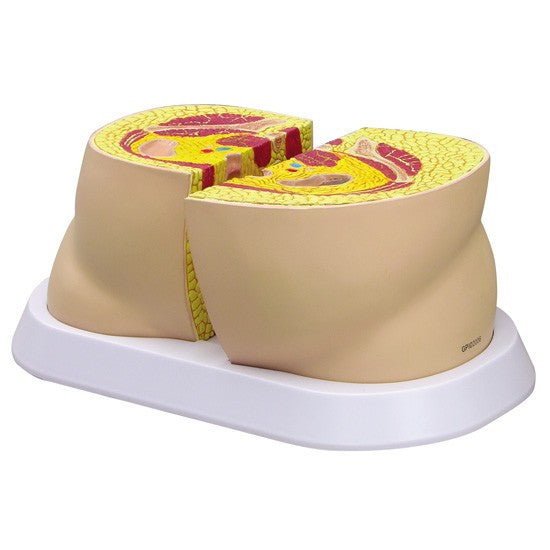 Obesity / Body Type Anatomy Model