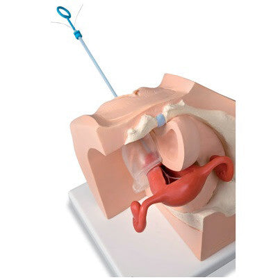 Gynaecological Patient Education Model