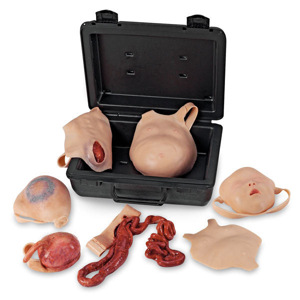 Neonatal Wound Kit PP08009