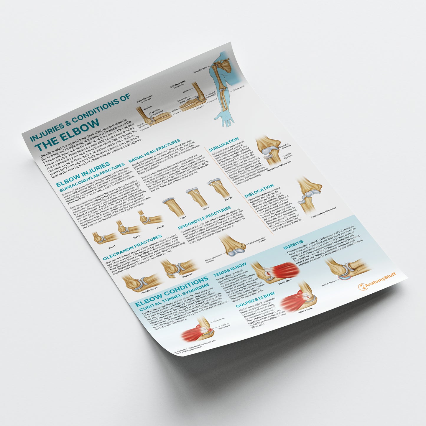 Injuries & Conditions of the Elbow Chart / Poster