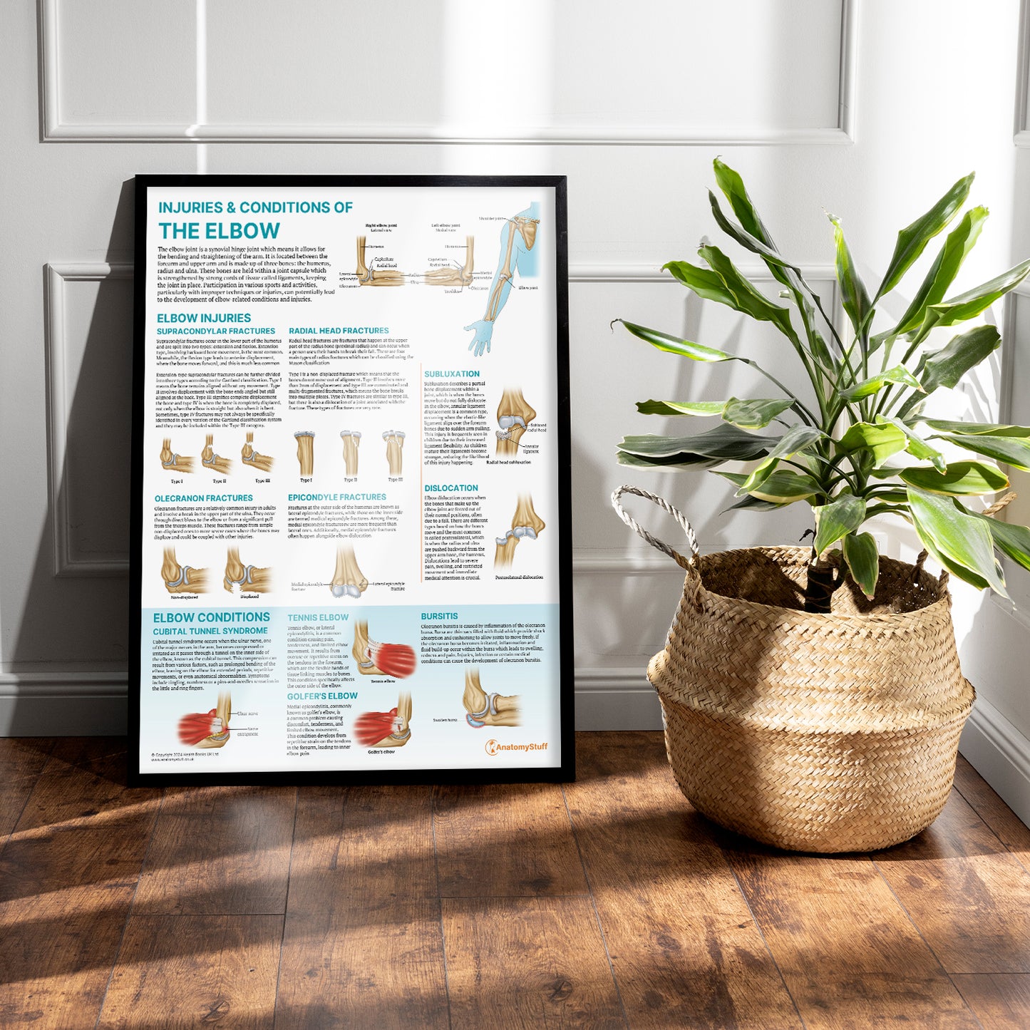 Injuries & Conditions of the Elbow Chart / Poster