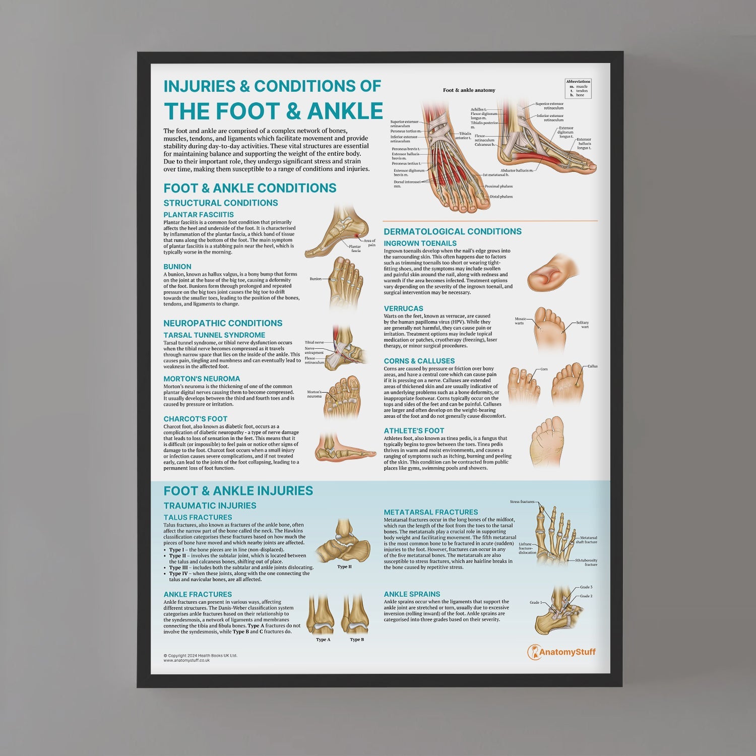 Injuries & Conditions of the Foot & Ankle Chart / Poster - Part of Collection