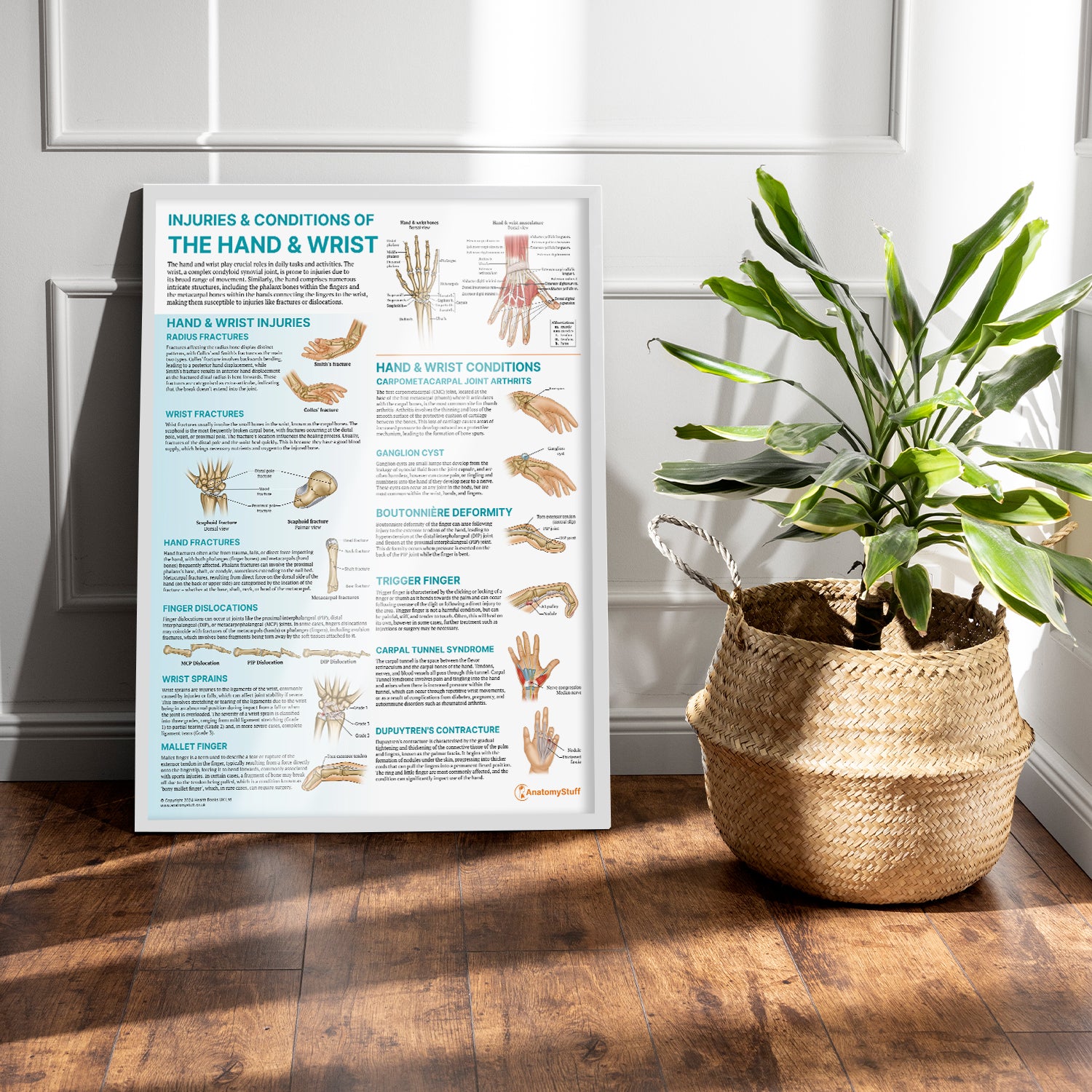 Injuries & Conditions of the Hand & Wrist Chart / Poster