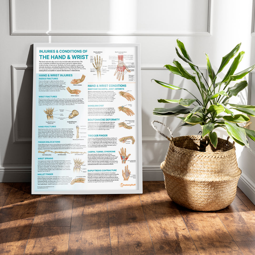 Injuries & Conditions of the Hand & Wrist Chart / Poster